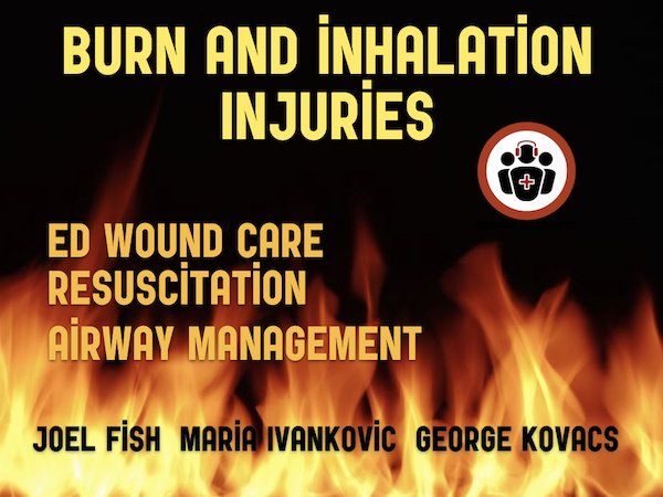 EMCases's tweet photo. Burn &amp; Inhalation Injuries: ED Wound Care, Resuscitation &amp; Airway Management with Joel Fish &amp; Maria Invankovic.

Special segment on awake intubation with @kovacsgj

Rule of 9's is dead. Same with Parkland. Same with daily dressings...
https://t.co/sVrwJnmGev
#FOAMed https://t.co/MZFpsv5uqn