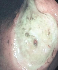 BMJLearning's tweet photo. Our #dyspepsia module is getting great feedback: "I thought it was a very good module indeed. It was evidence based throughout and the clinical scenarios were very typical of what you could easily see in clinic." https://t.co/eF8VKkZiOQ #medtrainee #foundationdocs #acutemedicine https://t.co/s0x5cx9fPa