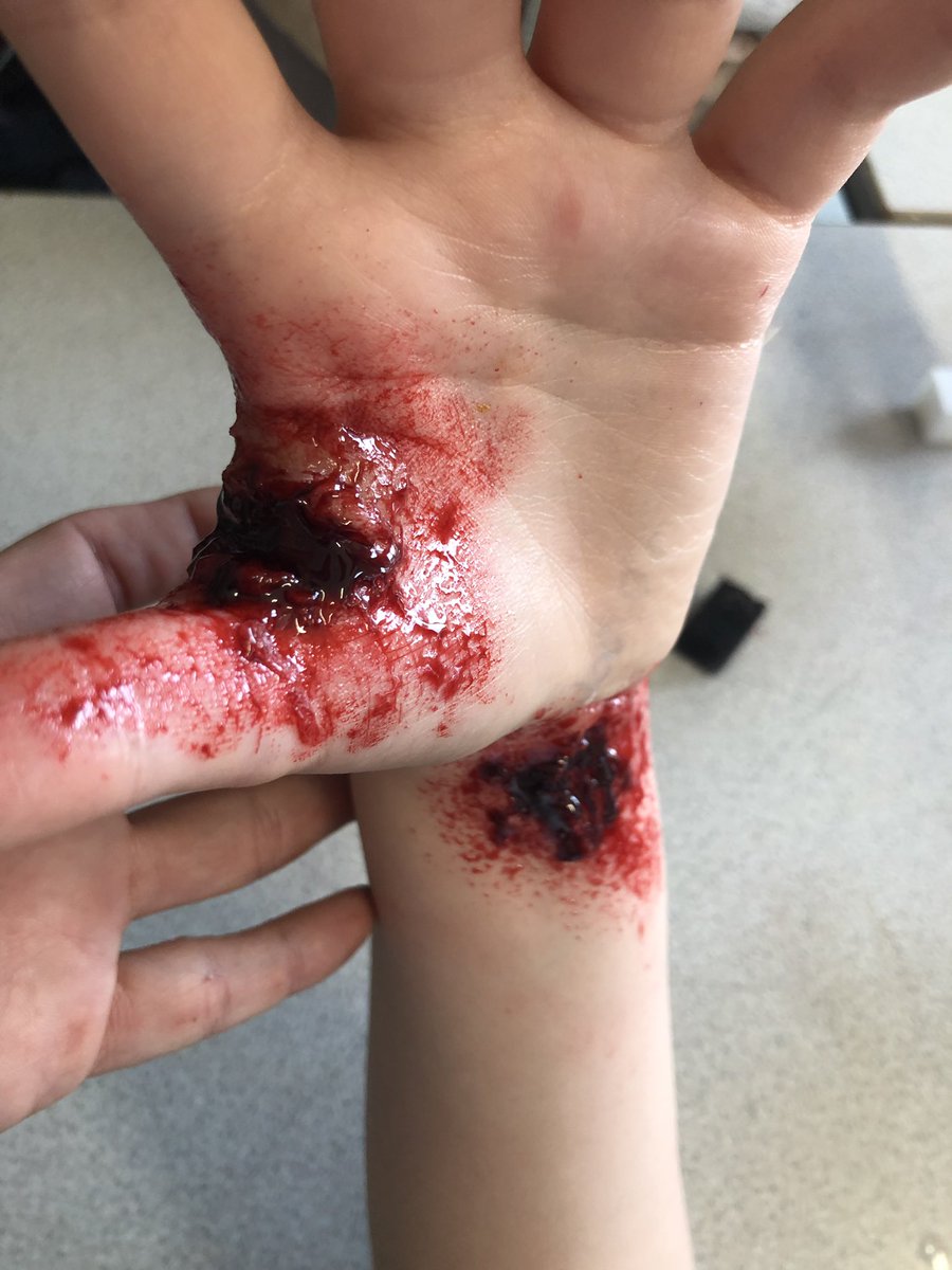 RAAArt2's tweet photo. Don’t leave sharp objects around the classroom 😉 more blood and gore @RAASchoolGatton https://t.co/bTFHwbGxMs