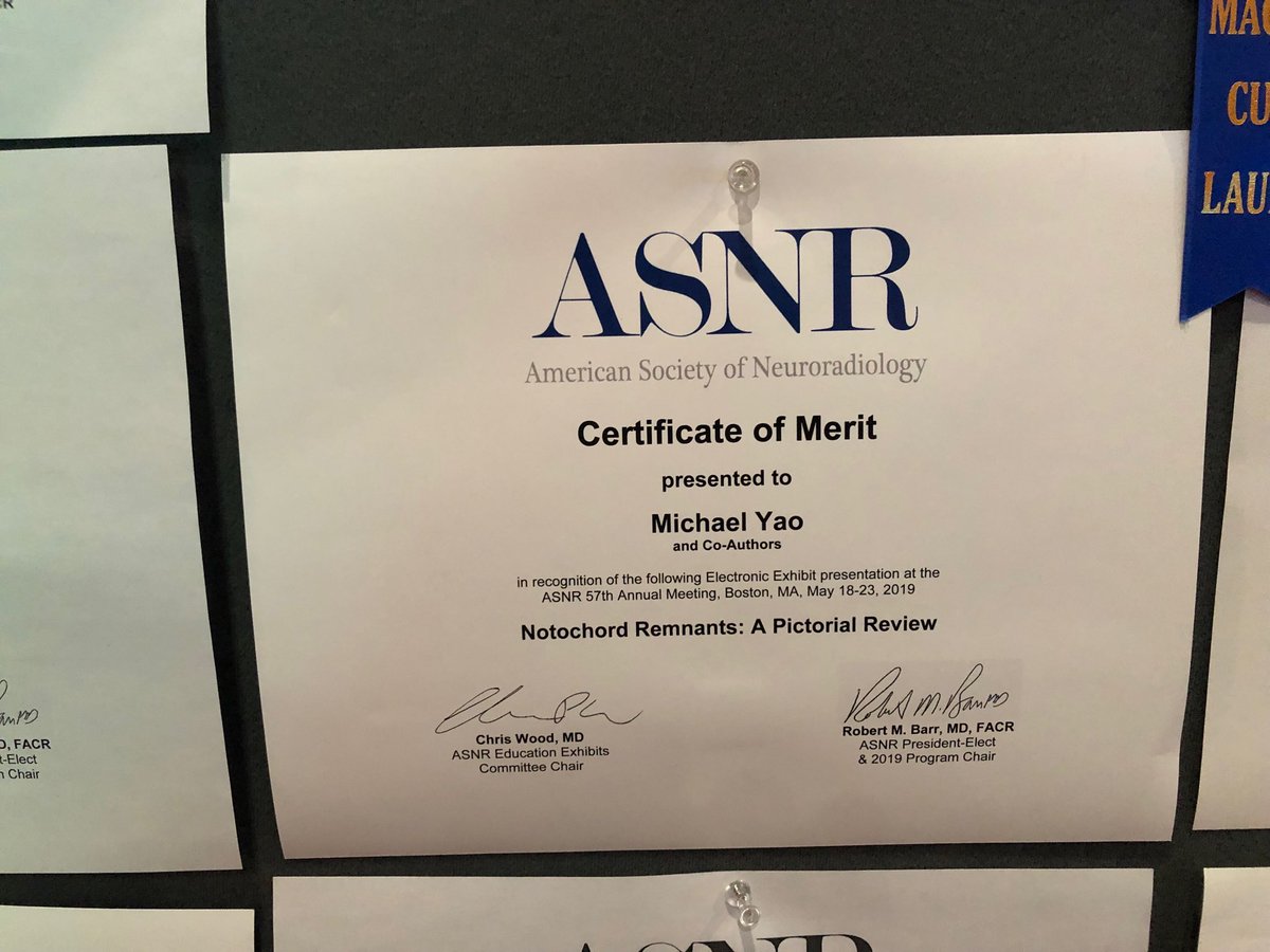 Shira Slasky (@shiraslaskymd) on Twitter photo Kudos to <a href="/MontefioreRAD/">Montefiore Radiology</a> residents Michael Yao @vptweets88 and neuro fellow @ParnesGregory on this well deserved award! Thanks for your strong work on our project! #ASNR19 Kudos to <a href="/MontefioreRAD/">Montefiore Radiology</a> residents Michael Yao @vptweets88 and neuro fellow @ParnesGregory on this well deserved award! Thanks for your strong work on our project! #ASNR19