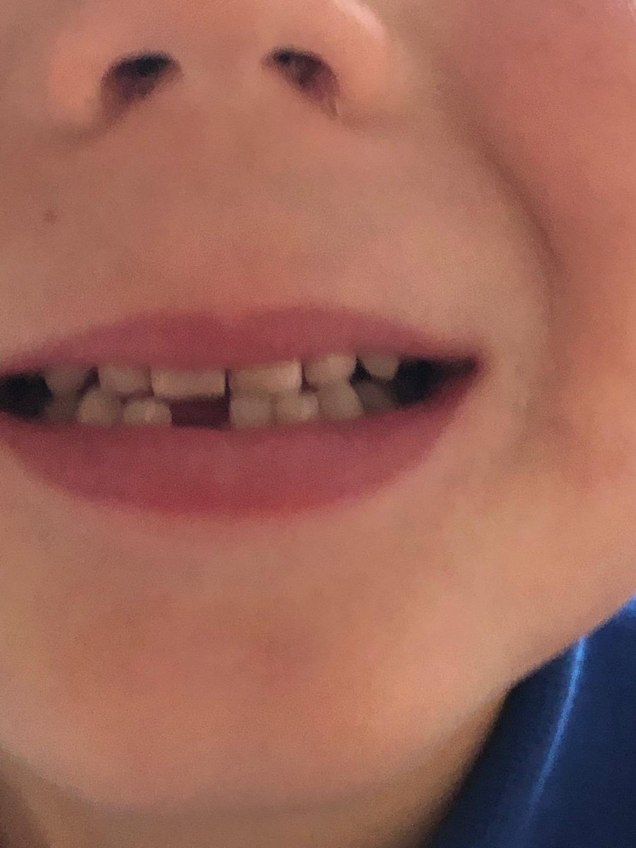 TracyStanbrook's tweet image. Jacob has lost his first tooth. He is so excited and proud. 😀 #toothfairyiscoming #losttooth @SouthfieldFS