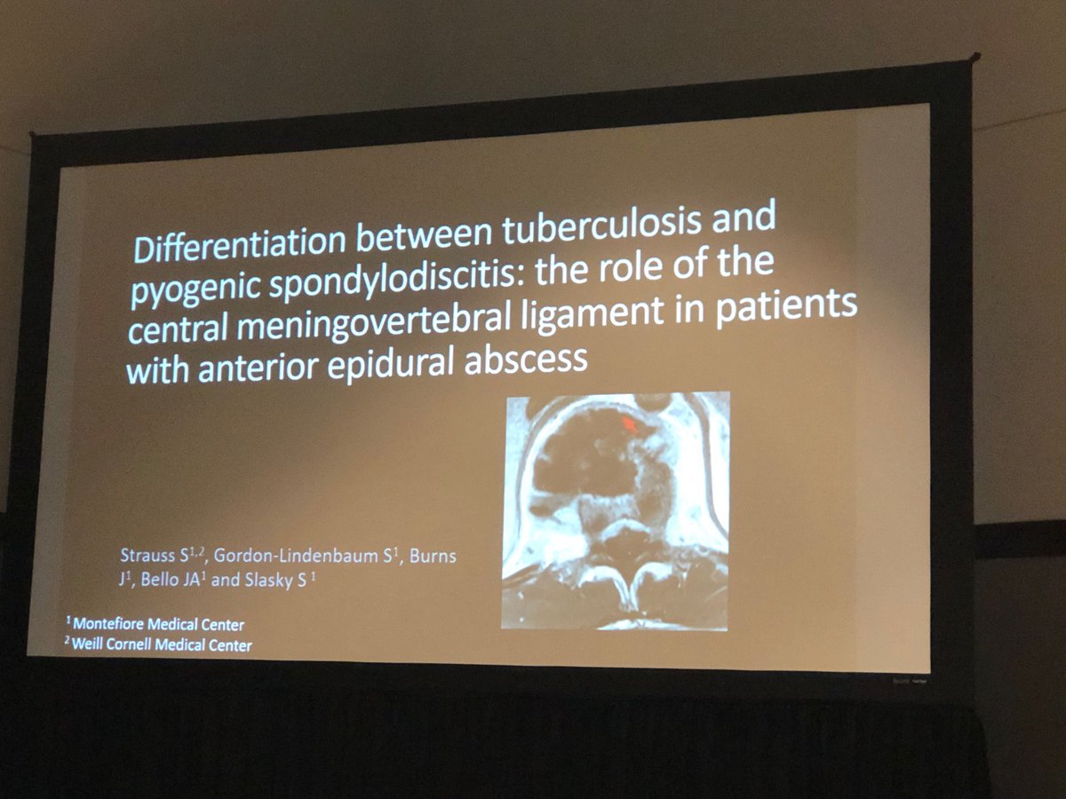 Great pres by former ⁦@MontefioreRAD⁩ res Sara Strauss demonstrating that intact meningovertebral ligament can differentiate between TB & pyogenic spondylodiscitis in the setting of epidural abscess. #ASNR19 ⁦@JudahBurnsMD⁩ ⁦⁦⁦⁦⁦@JBelloMD⁩