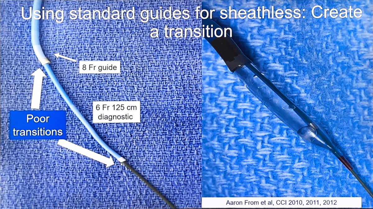 SVRaoMD's tweet image. Techniques for sheathless guides for large bore #RadialFirst by ⁦@rajivxgulati⁩ #SCAI2019