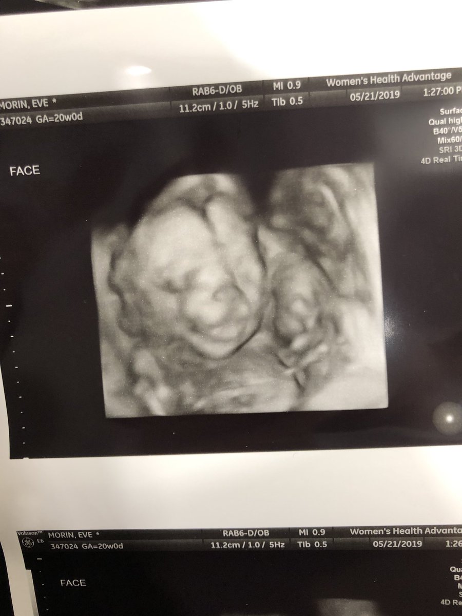 juliaemorin's tweet photo. Of all of the gifts life has to offer, YOU by far are the greatest one 💙💜❤️ we’re half way there baby 🤞🏼🧸🍼 #20weekstogo https://t.co/ltIBDss0J5