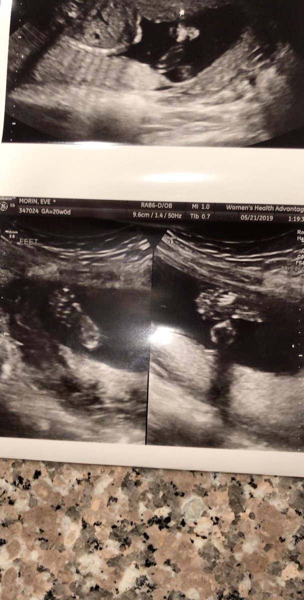 juliaemorin's tweet photo. Of all of the gifts life has to offer, YOU by far are the greatest one 💙💜❤️ we’re half way there baby 🤞🏼🧸🍼 #20weekstogo https://t.co/ltIBDss0J5