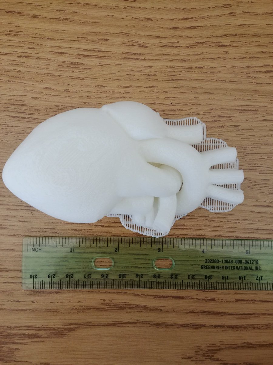 MrsRiggs1's tweet image. How do you learn about the circulatory system? We build and print hearts ❤❤ @Afinia3DPrint #leanintothelearning #STEM #STEMedu @eyms_york @EYMSHealth