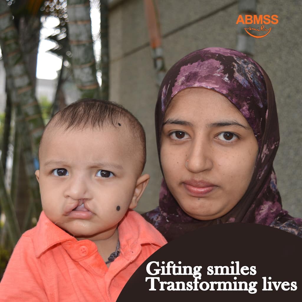 cleftindia's tweet photo. At ABMSS, we believe that every child deserves a safe and well timed surgical care.

#surgicalcare #cleftcare #cleftcharity #partnership #freecleftsurgery #comprehensicecare #CCC #hospitals #cleftindia #abmss https://t.co/Zb2TrtSaQE