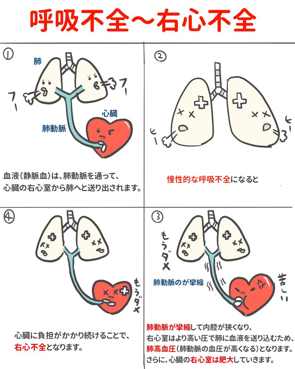 ゴロ 解剖生理イラスト Na Tviteru 4コマで分かる 呼吸不全 右心不全のメカニズム この4コマのストーリーで覚えれば 呼吸不全 肺高血圧症 右心室肥大 右心不全の流れが 一気に覚えられます