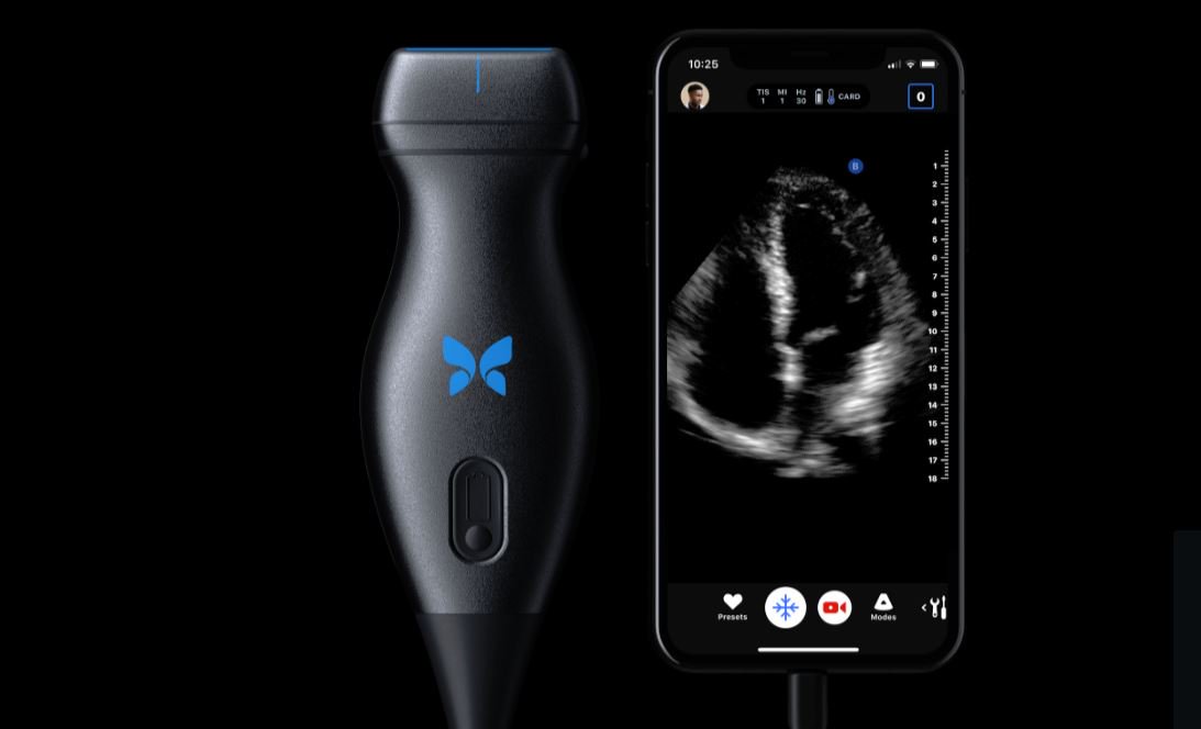 Hom2Connecticus's tweet image. iQ, le futur échographe de poche pour iPhone #e-santé #échographe #suivi-grossesse dlvr.it/R5BbyN