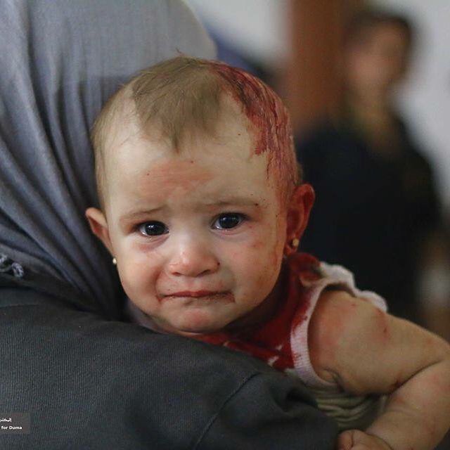 InqlabiDstk1947's tweet photo. The silence of the world on the drama of Syrian children, is the failure of humanity ...
#syrianchildren #SyriaIsCalling https://t.co/5ipCm6KU5q https://t.co/35WfDdPJf8
