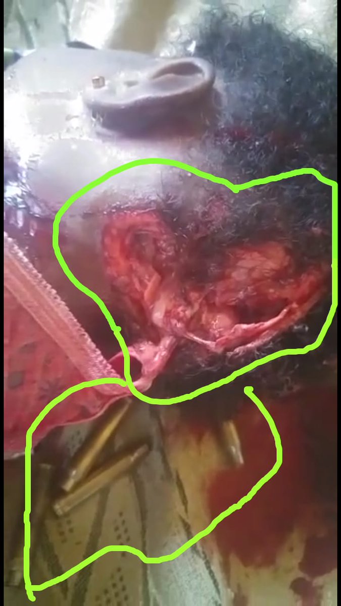silas_atefor's tweet photo. @innercitypress @antonioguterres @UN_Spokesperson @StephDujarric @NeverAgainGC @cameroonvoice @cameroondailyjo @FUNCA_info @MatthewLeeICP @MatthewLeeICP as usual @StephDujarric &amp; #BigTonyCorruptsTheUN monitoring the killing of  #BabyMartha.Waiting for more of #Demented @PR_Paul_BIYA #Goldenstatues to cover up. As always push @innercitypress 1/2 a 1000 question to the trash for refusing to conspire.#322days #ICPban https://t.co/r5Rg4Eivkx