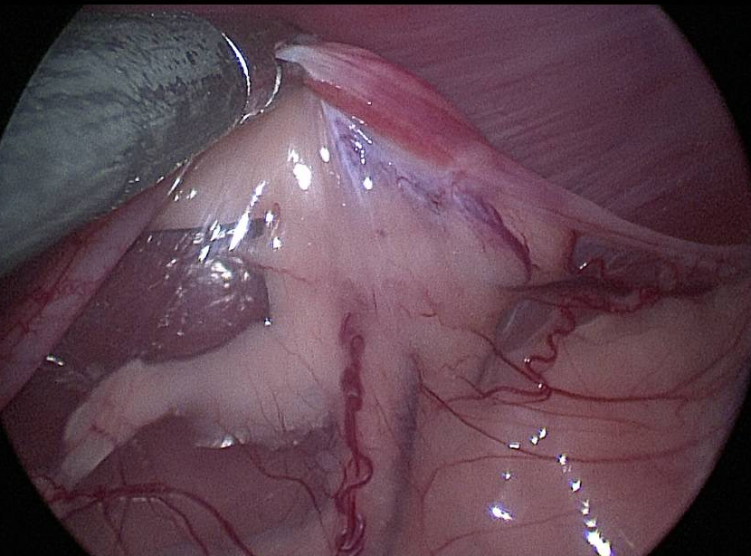 Chris Thomson tweet media