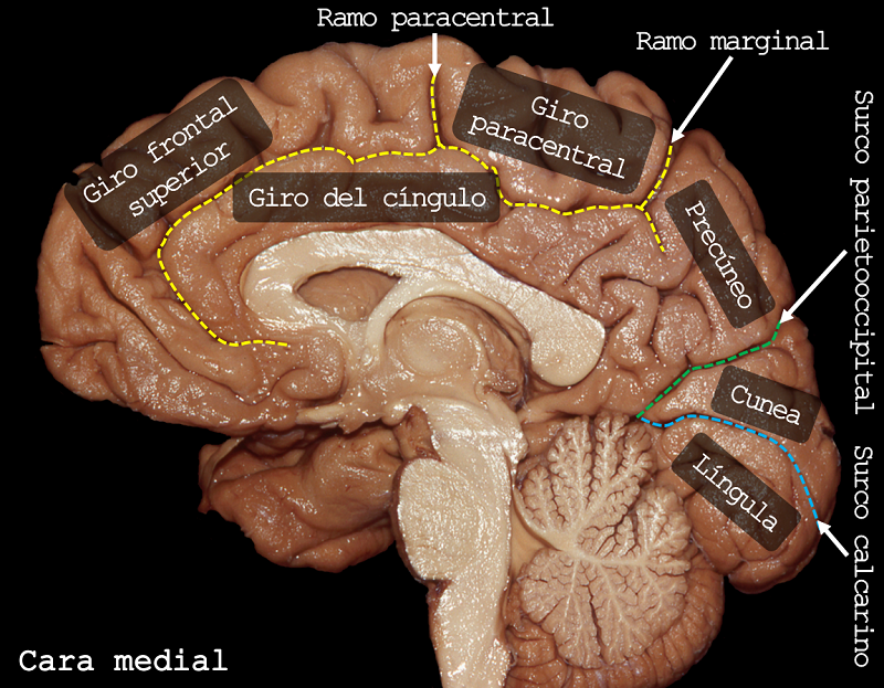 aeducar's tweet photo. Superficie cerebral medial 🧠
✅ | Leer: https://t.co/OxeQjtBqfq
✒️ | Autor: Dr. Facundo Rodríguez, Médico Neurocirujano.
#anatomia #neuroanatomia #sistemanervioso #cerebro #lobuloscerebrales #lobulofrontal #lobuloparietal #lobulooccipital #lobulotemporal #asociacioneducar https://t.co/qkL0ng2yWg
