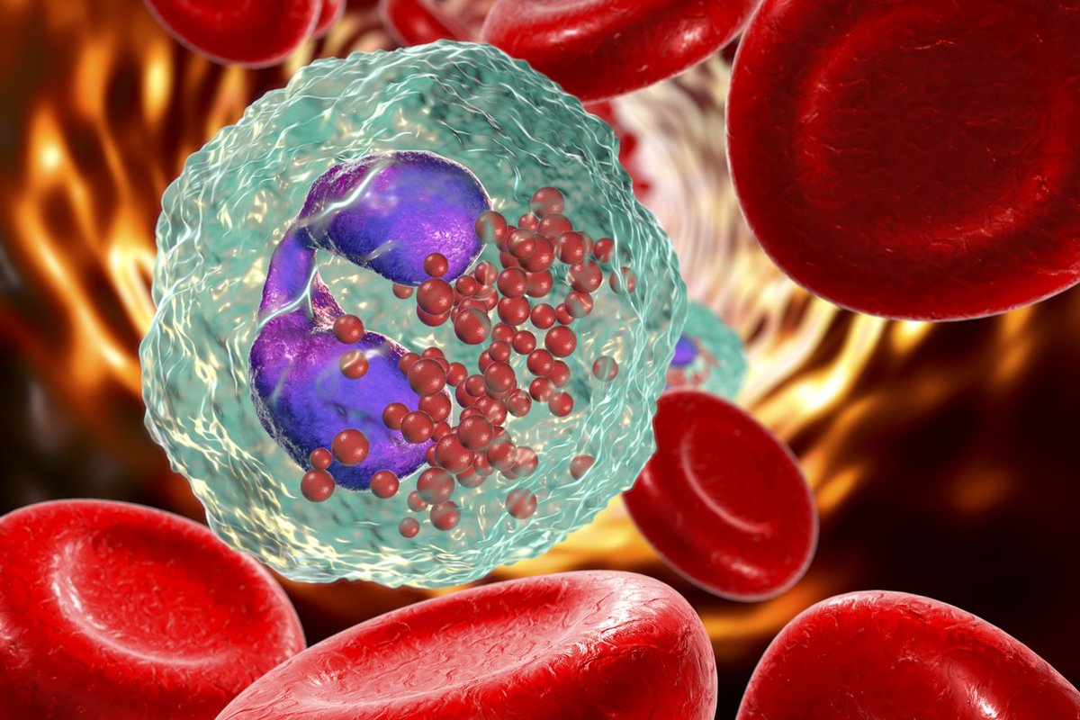 OhMyAllergy's tweet photo. Patients with eosinophilic #asthma have higher levels of eosinophils, a type of white blood cell. https://t.co/RkNMqSHUYK https://t.co/fQawTWdDOb