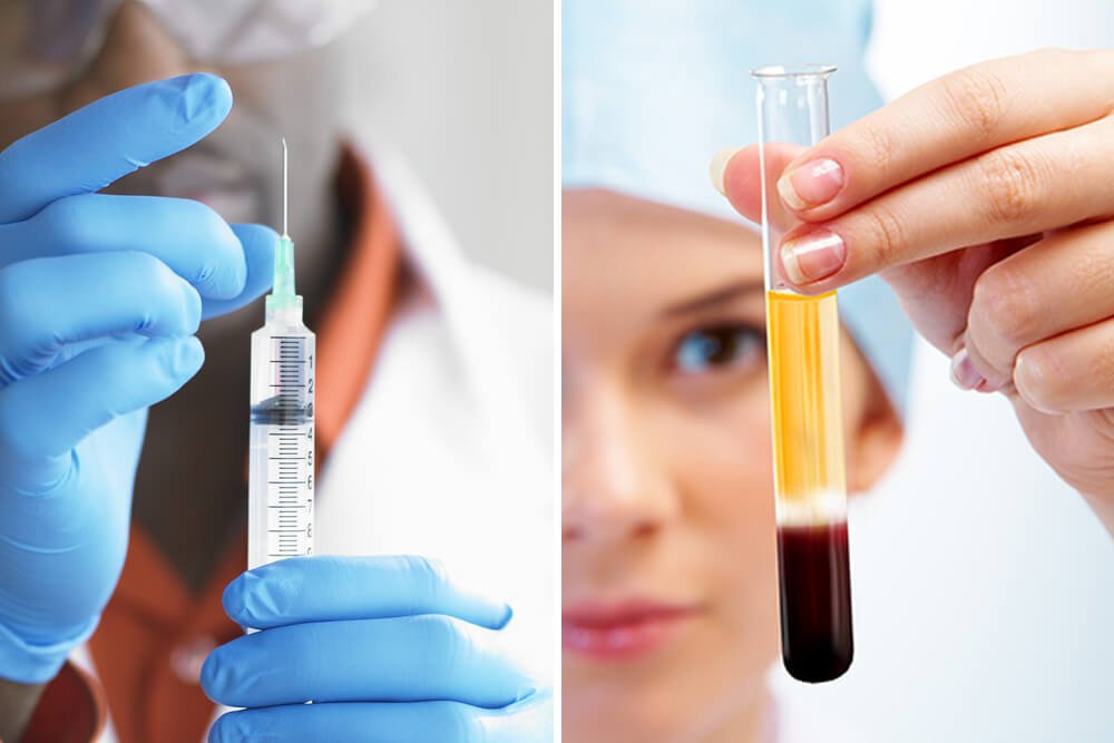 PRP Specialists in Frisco, Texas
(ow.ly/oZ4y30onHCG)

#PRP #regenerativemedicine #FriscoTX