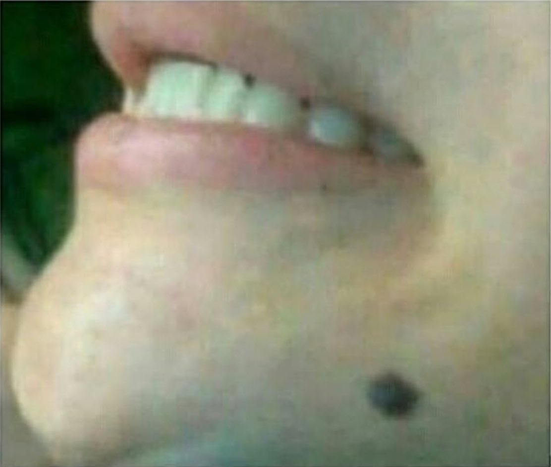 Dinga_lvr's tweet image. J’suis au bout d’ma vie quand j’retourne la photo j’ai l’impression de voir un requin content 😂😭