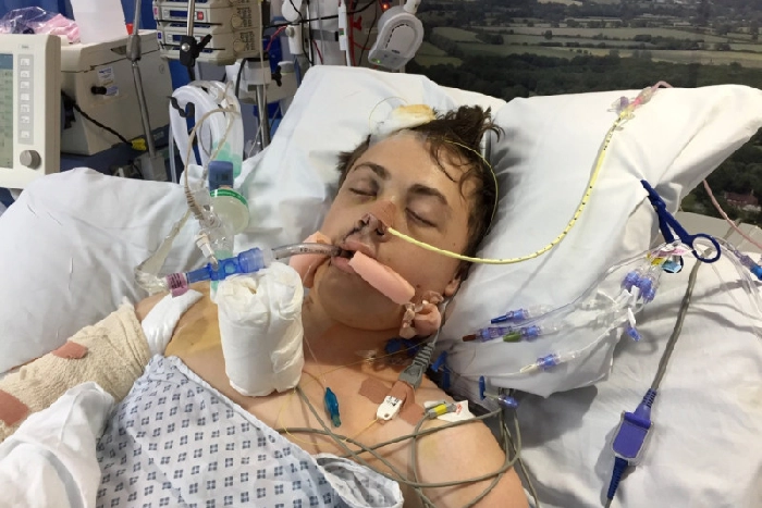 Ryan Selby was motorcycling in Hastings, when an illegally parked driver opened his car door without looking, forcing him into an oncoming bus. He was in a coma for 11 days and suffered multiple life-changing injuries. The uninsured and unlicensed driver received an 18 month ban.