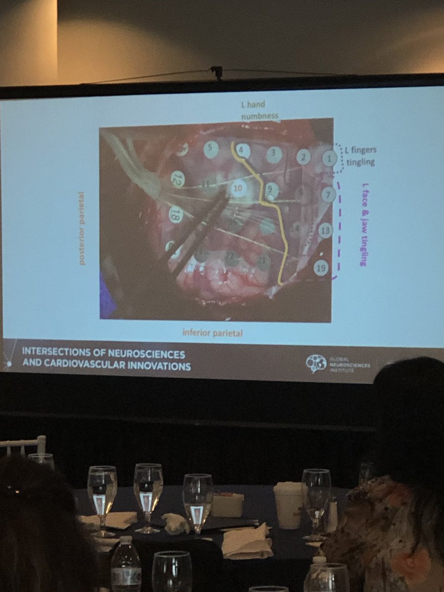 Dr Erol Veznedaroglu (@dr_vez) on Twitter photo Dr. Atom Sarkar fascinates the crowd with the amazing revolutions of functional neurosurgery during the Intersections of Neurosciences and Cardiovascular Innovations Conference. <a href="/LourdesHealth/">Our Lady of Lourdes Health</a> #neurosciences #innovations #gni #neuro Dr. Atom Sarkar fascinates the crowd with the amazing revolutions of functional neurosurgery during the Intersections of Neurosciences and Cardiovascular Innovations Conference. <a href="/LourdesHealth/">Our Lady of Lourdes Health</a> #neurosciences #innovations #gni #neuro