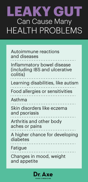 Autoimmune diseases (like  #lupus) can be affected by a leaky gut. If you're looking for detail on what that is and what tests to get, this article goes deep.  https://draxe.com/leaky-gut-test/ via  #draxe  #LupusAwarenessMonth  #AutoImmuneWarrior