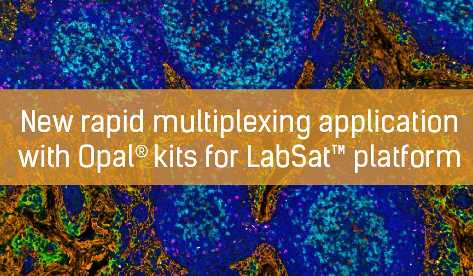 lunaphore's tweet photo. We are very pleased to announce that a new rapid multiplexing application is available on Lunaphore's LabSat™ platform, following the signature of a co-marketing agreement with Akoya Biosciences. #multiplexing #ihcpath
Read the full press release: https://t.co/Ftfo13Qb7l https://t.co/vbYFeRYmXU