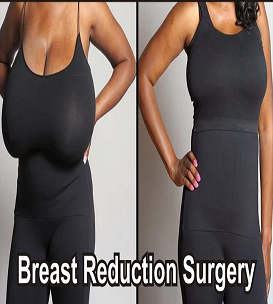 Northexsurgery's tweet photo. *GET BACK YOUR SEXY CURVES*
Feel different from @Northexsurgery.
#breastaugmentation is imported and highly effective.
Feel free to contact us.
#breastenlargement 
#breastsurgery 
#breastlift
#brestsurgeon 
#breastreduction
#cosmeticsurgery 
For details: inbox us https://t.co/05a1SULT3e