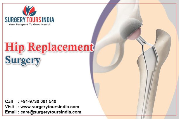 surgery_tour's tweet photo. #Surgery Tours India offers affordable cost #hip #replacement #Surgery in India's Top Hospitals with world class #hip #replacement Surgery facilities. Book an appointment now. Call: +91-8882921234 | +91-9730001540
Visit: https://t.co/ymYL0RzOyi
#hipreplacement #Orthopedic #doctor https://t.co/YxlM7BXBUn