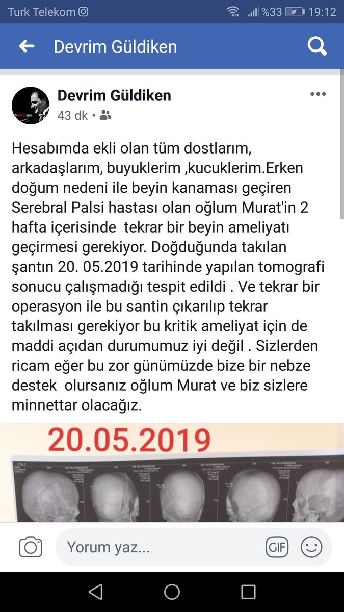 Dostlarım , oğlum murat tekrar kritik bir beyin ameliyatı gecirecek yazıyı buraya  sigdiramadigim için Facebook üzerinde yayinladigim yazıyı buraya bu sekilde koymak durumunda kaldım. Destek  olursanız oğlum Murat ve biz sizlere minnettar kalacagiz.