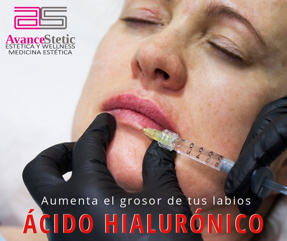 Avancestetic's tweet photo. Mediante una técnica mínimamente invasiva en AvanceStetic realizamos pequeñas infiltraciones de #ácidohialurónico para aumentar el #grosor, destacar el #perfilado, elevar las comisuras e hidratar los #labios.
Llámanos y te informaremos sin ningún compromiso. https://t.co/NxpaXhwRGo
