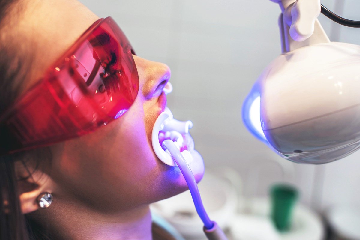 MapleHygiene's tweet photo. Getting professional #teethwhitening isn’t for everyone. Make sure #teeth whitening procedures are safe for you by reading our recent #blog. #dentalcare #dentalhygienist #oralcare 
Link 👉 https://t.co/zKE6u0kgBq https://t.co/eRUdlETyB3