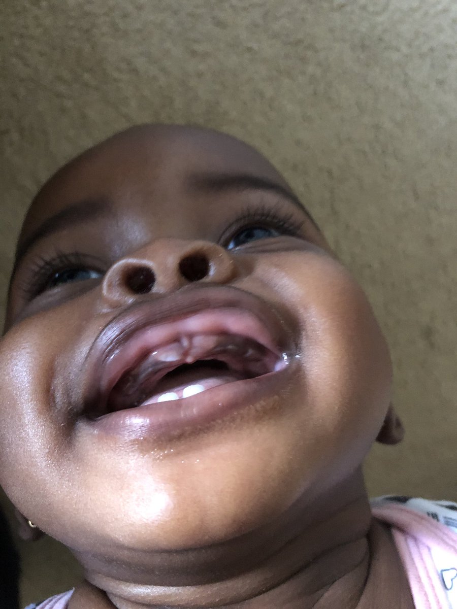 TiredAsAMothaa's tweet photo. Somebody’s got more teeth coming in 😩 https://t.co/zF3Khrh8h5