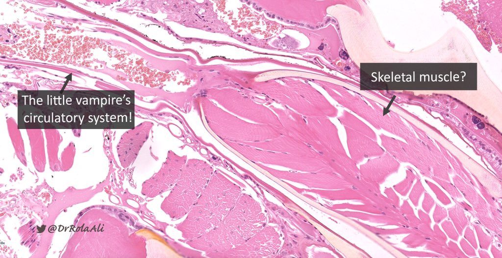 Rola Ali, MD tweet media