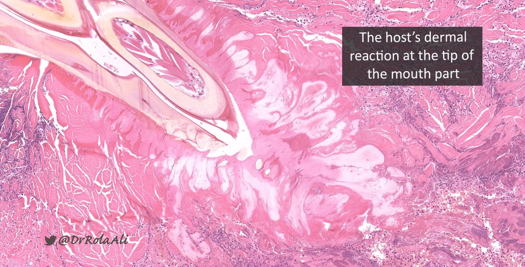 Rola Ali, MD tweet media