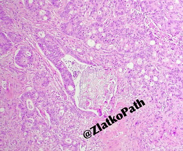 Zlatko Marusic tweet media