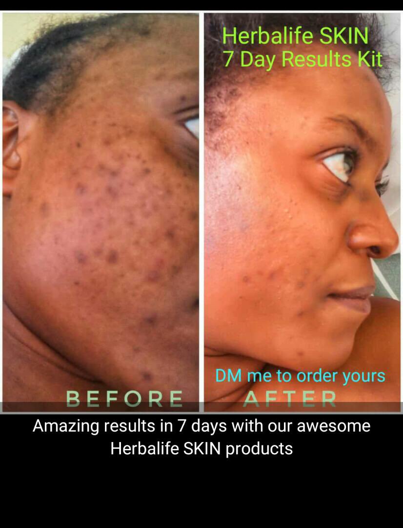 herbalife skin results
