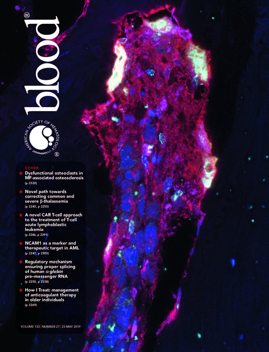 BloodPortfolio's tweet photo. Check out this week’s issue of Blood: https://t.co/eInmSzLMKO #hematology https://t.co/GcE6bBK2jf