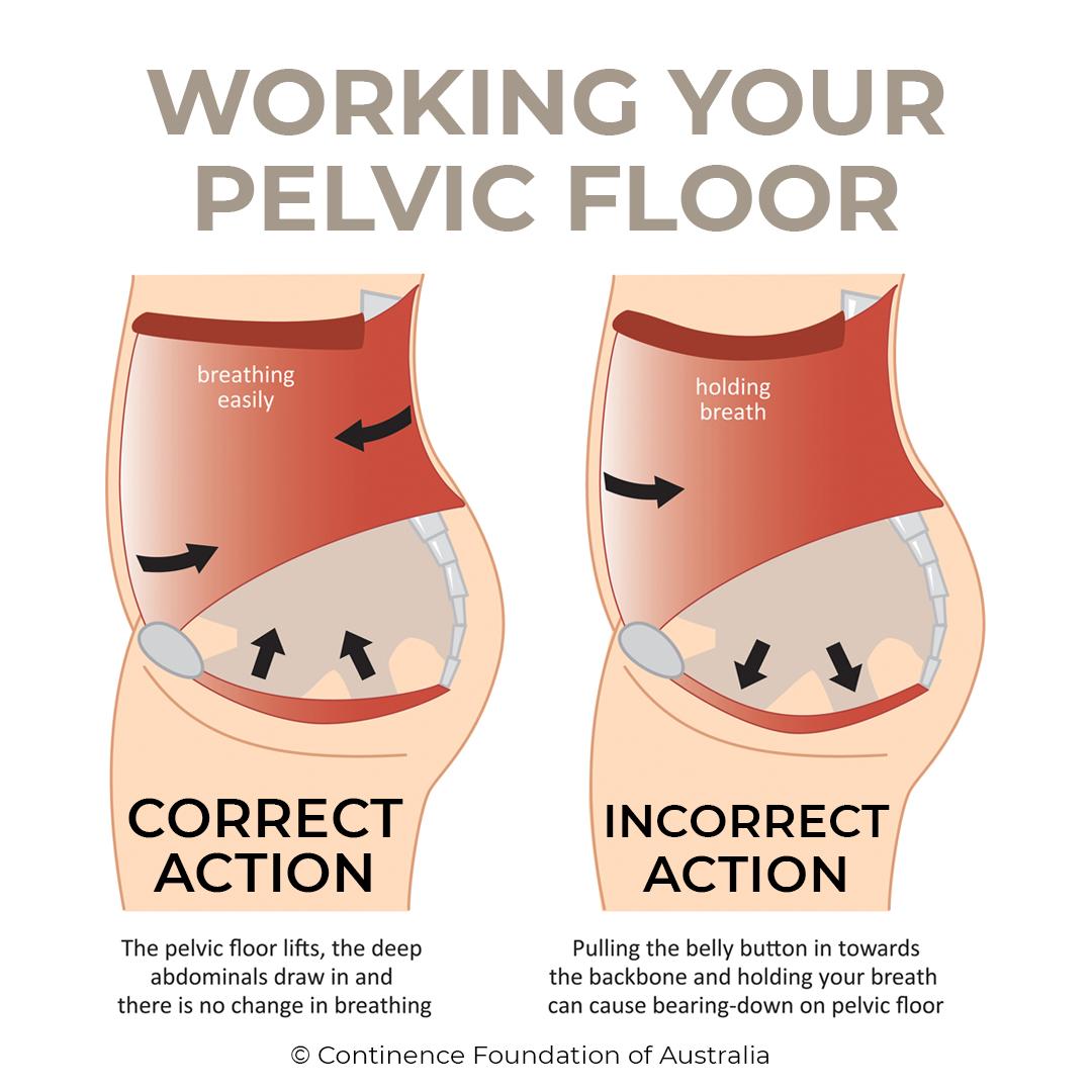ContinenceFoundation on X: For day 5 of #ExerciseRight Week, we're  covering how to work your pelvic floor. The diagram shows a pelvic muscle  contraction. The CORRECT action is on the LEFT: 🔸
