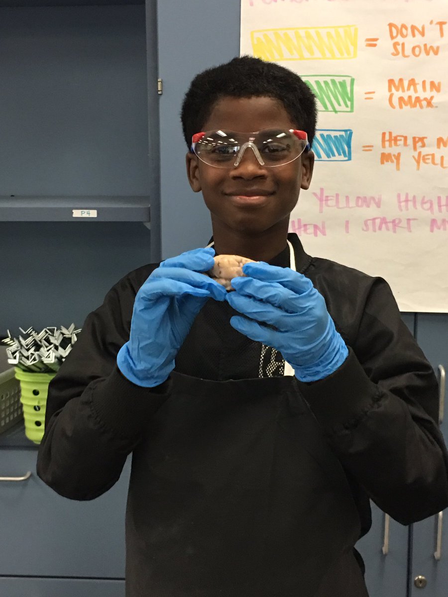DoerschukPLTW's tweet photo. Today in medical detectives, 6th graders dissected a sheep’s brain. They showed off their skills of knowing the various parts of the brain after learning about them in their PBL on concussions #thisiswhatSTEMlookslike #AMSpresents #handsonlearning https://t.co/KqBieByo5y