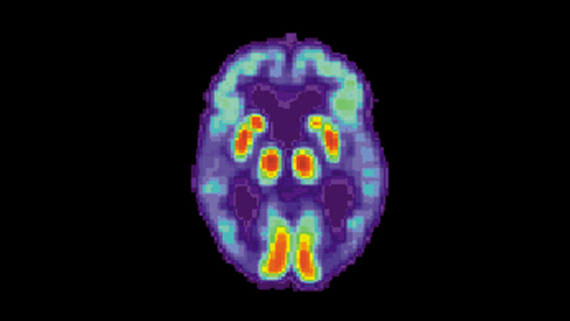 nlokeshn's tweet photo. #AI #machinelearning #Alzheimers @UCSF #Healthcare https://t.co/DIaK3UYmxA https://t.co/qErTRsywAP