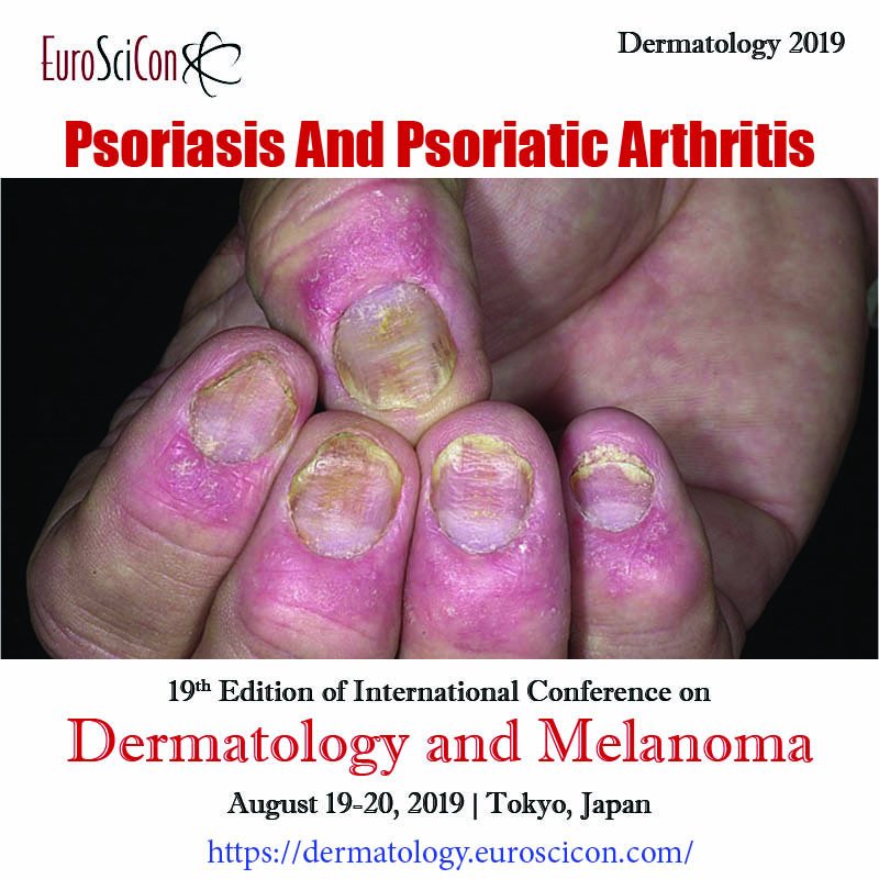 DermaCong_2019's tweet photo. More updates on Dermatology 
Red hair-related gene variant may contribute to link between melanoma and Parkinson's disease.
#skincancer #skindiseases #melanoma #cosmetology #chemotherapy #immunology #venereology #lasertreatments #cosmeticsurgery #skincare #trichology https://t.co/uRLHJ0KdJF