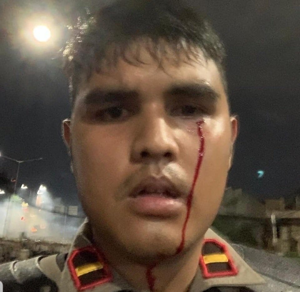 Pak <a href="/aniesbaswedan/">Anies Rasyid Baswedan</a>, apakah Anda sudah jenguk korban aparat yg luka-luka karena lemparan batu, beling, dan panah?

Mereka rela berjuang mati-matian demi menjaga keamanan Jakarta. Atau Anda hanya akan bilang, "Itu kan sudah tugas aparat keamanan"?