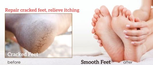 BraphyMask's tweet image. Best Seller -- Exfoliating Foot Mask - mailchi.mp/599ddf3e77c0/b…