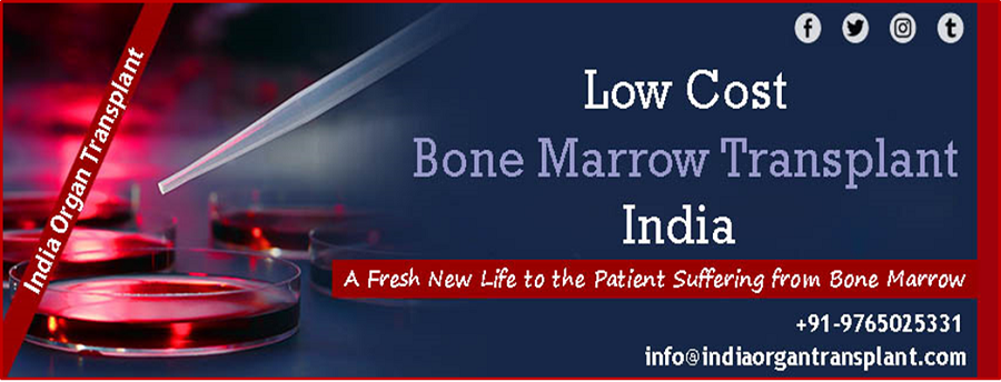 indiaorgantrans's tweet photo. India has become a #MedicalTourismDestination of #BoneMarrowTransplant operation for the availability of #ExperiencedSurgeons and advanced skill set of #BestBoneMarrowTransplantSpecialistsinIndia. For more details Call: +91-9765025331
https://t.co/K0N62anb94 https://t.co/JwMpVTDGHN