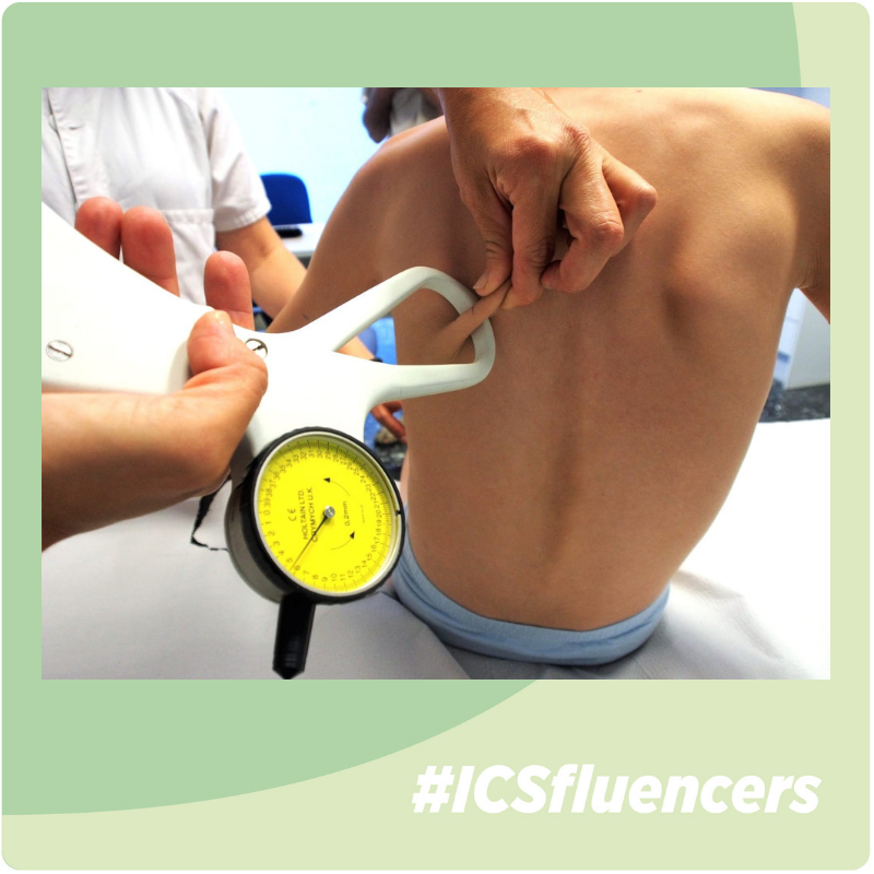 icscat's tweet photo. @VernicaLuque4 @IISPereVirgili @hjoan23 @universitatURV #ICSfluencers @VernicaLuque4:
"Amb antropometria valorem les reserves de teixit gras i muscular. Això ens dona informació sobre el tipus i grau de malnutrició per fer un suport nutricional adequat.
@hjoan23 @CoDiNuCat @URVmedicina #InversioSalut @IISPereVirgili " #S7VL https://t.co/BBqXRSX1av