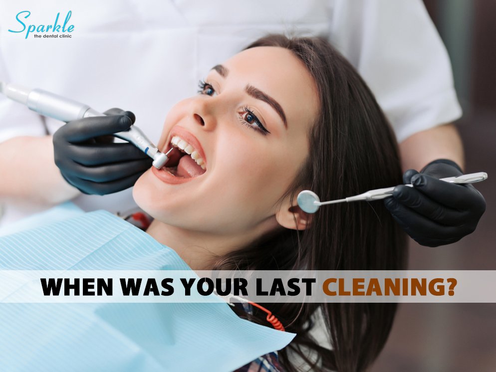 The healthier your #teeth are the happier you look.
Sparkle The Dental Clinic offers #teethcleaning services to aid in the removal of plaque to maximize your #oralhealth. 
Visit the #best #dentalclinic in #Pune.
Call For An Appointment: 9730987134
Visit: sparkledentalclinic.com