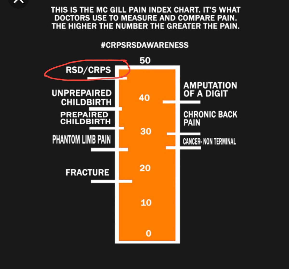 DanBoon63784314's tweet photo. #CRPS #crpsawareness #crpscanspread #Incurable 1 reason I fight for wife & everyone suffering from this horrific disease. #mnleg
Take a look at what can happen.
#Insurance won't pay 4 #IVIG4CRPS 2 help. But said, "We will cover amputation if needed".
https://t.co/Sorqjswav2 https://t.co/s5du0cAt7N