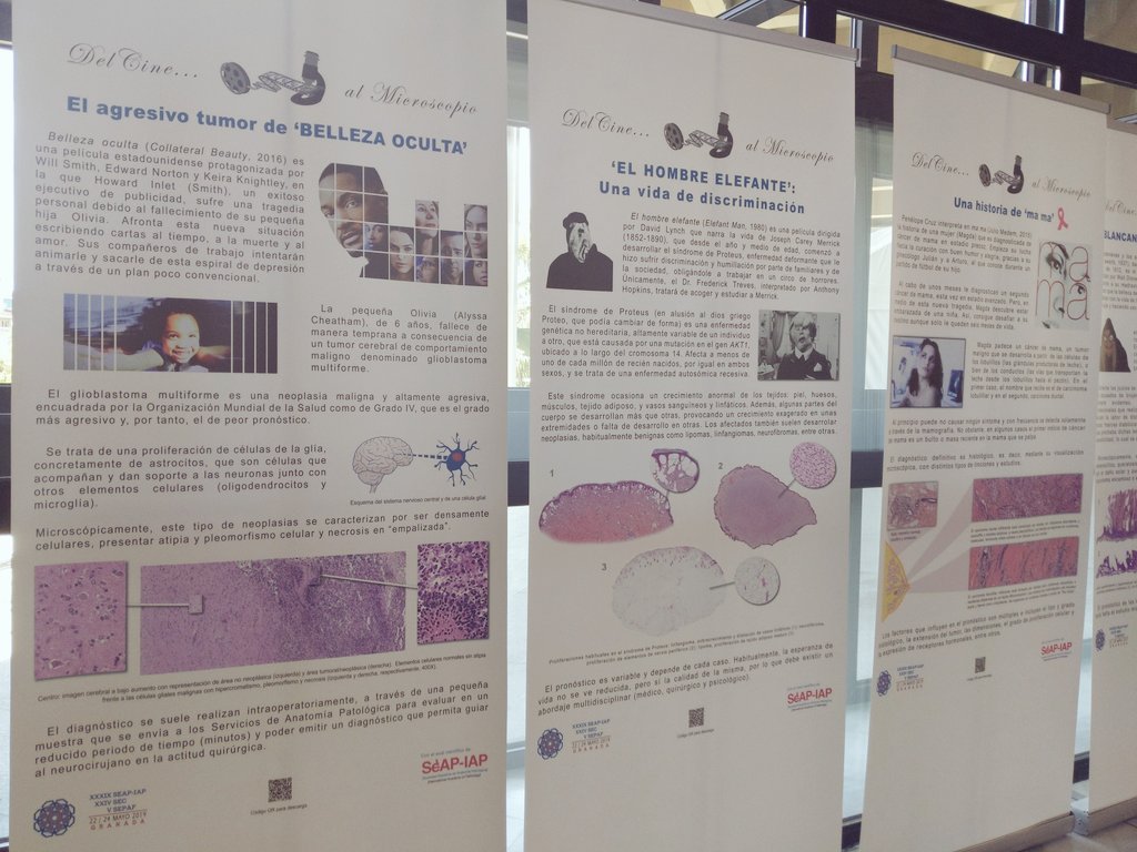 zucchiatti_'s tweet photo. Great ideas at #SEAP2019G 🙂💥
Pathology & cinema: actors in movies with some pathologic entities.
#MacroMicroContest trying to guess diagnosis just with big slides.
Thank you for all your effort. @SEAP_IAP https://t.co/NuN3HmbZq9