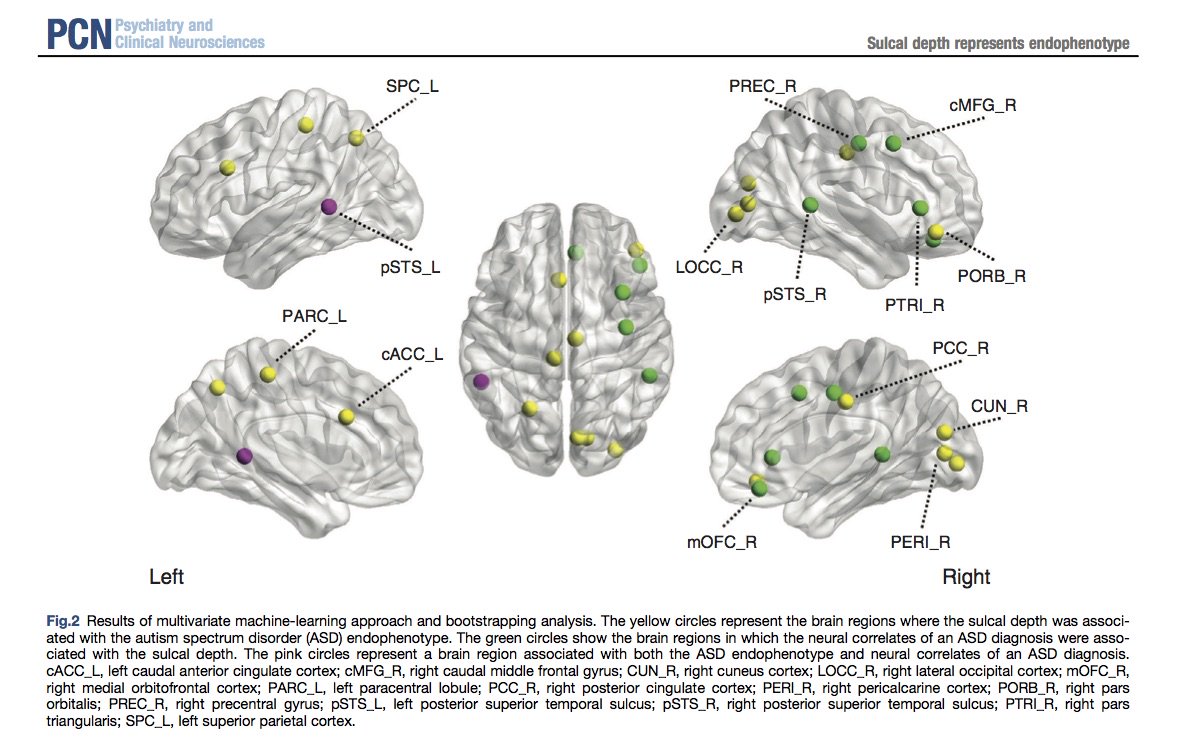 PCN_Psychiatry's tweet photo. A new article has been published! "Cortical surface architecture endophenotype and correlates of clinical diagnosis of autism spectrum disorder" by Yamagata et al. https://t.co/spTaKNIV3I
#ASD #autism #endophenotype #sibling #structure #MRI https://t.co/8Dl0mzB1wb