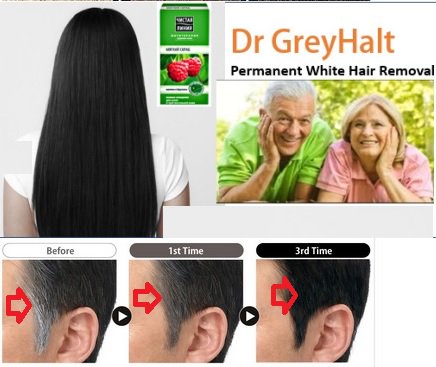 8 Natural Remedies To Get Rid Of White Hair At A Young Age