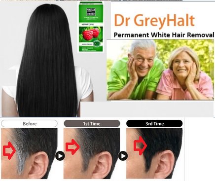 Permanent Hair Remov On Twitter Dr Greyhalt Brilliant Ways To