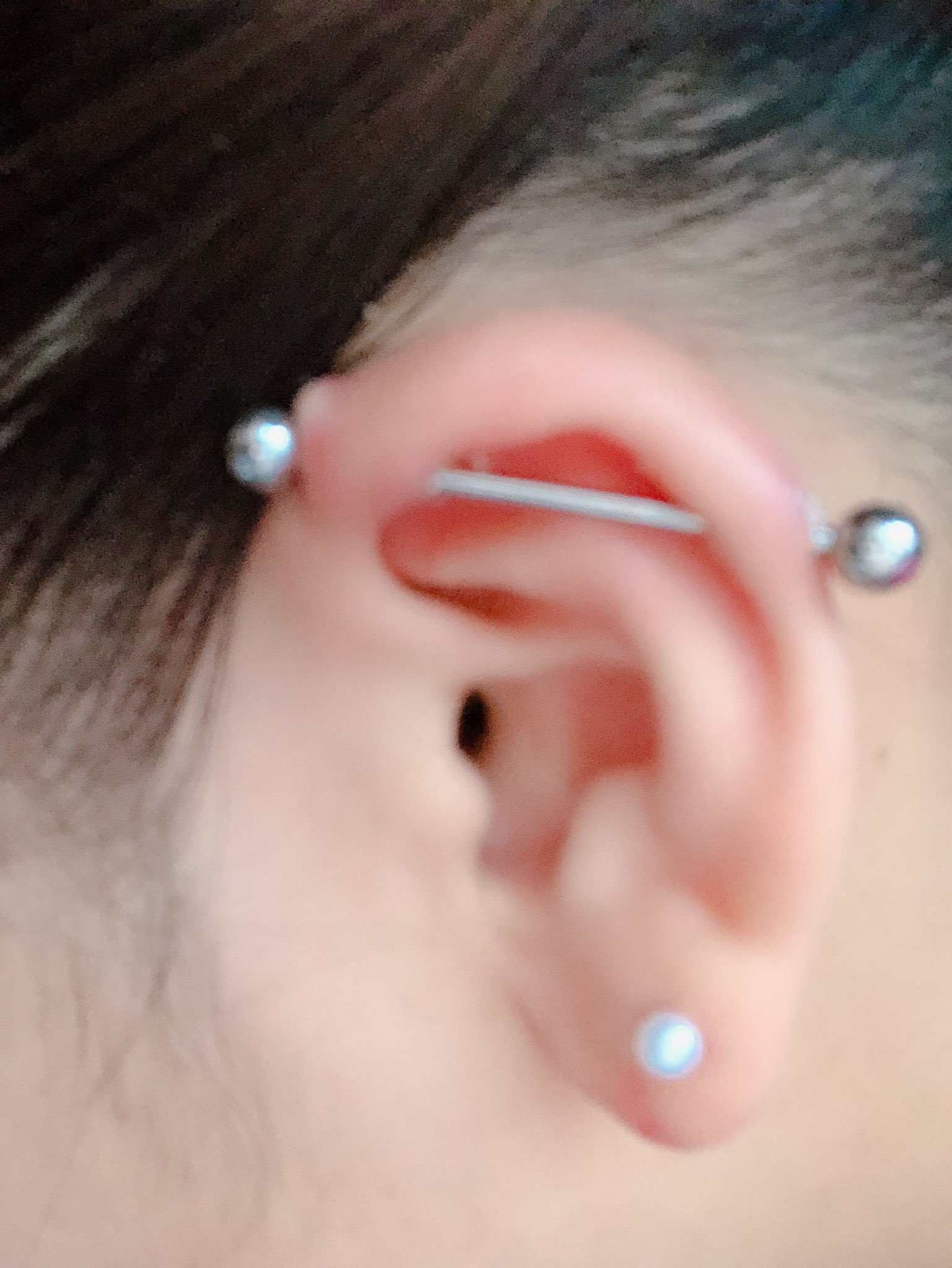 肉芽 Twitter Search Twitter